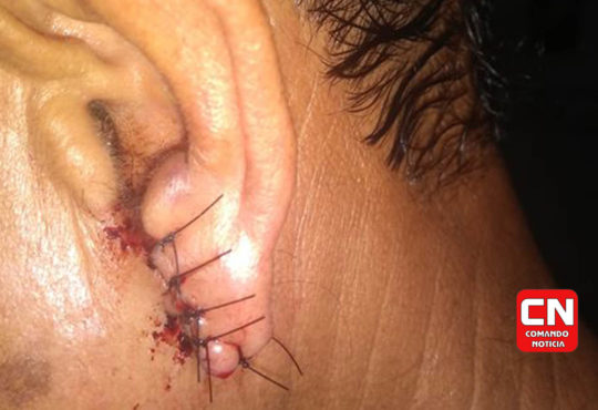 Orelha cortada por ladrão cópia