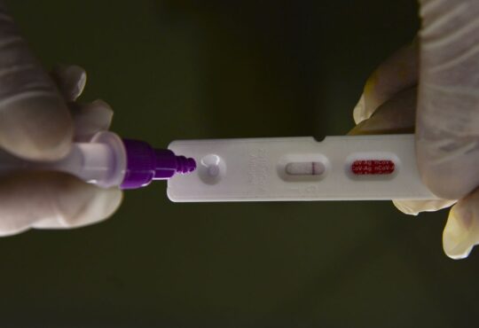 Teste rápido antígeno para covid 19