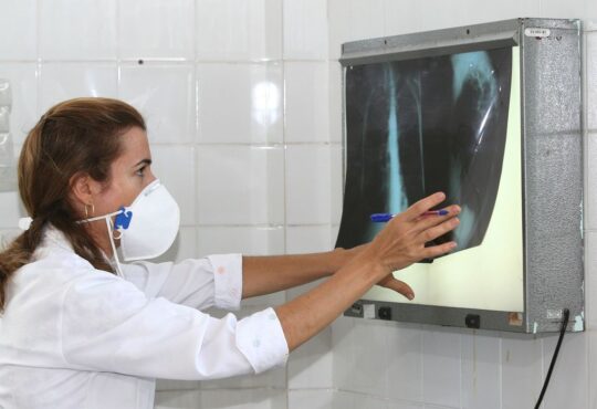 Dia mundial de combate à tuberculosena foto:autora: carol garcia / agecom