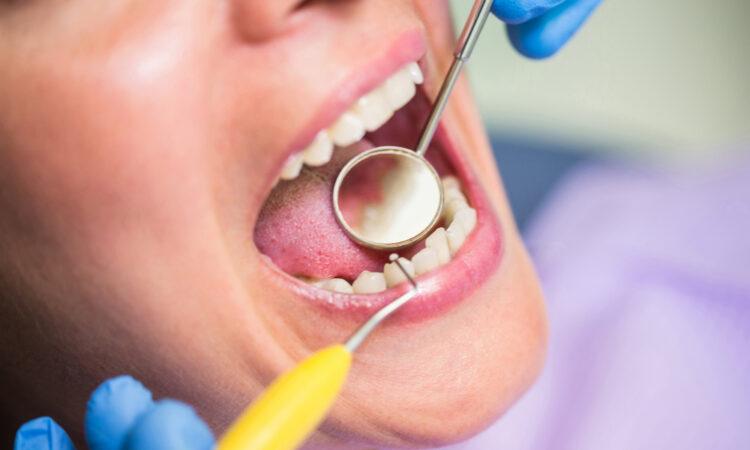 Vape dentistas nem comunicação
