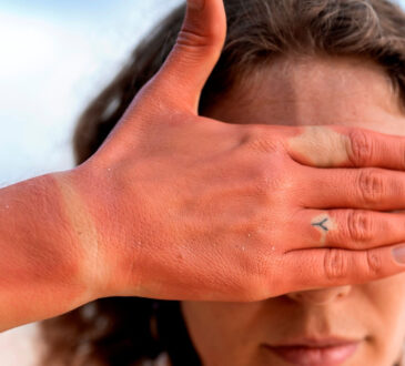 Radiação aquecimento eutrópia turazzi cópia