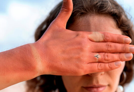 Radiação aquecimento eutrópia turazzi cópia