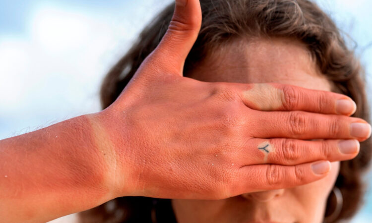 Radiação aquecimento eutrópia turazzi cópia