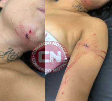 Adolescente É agredida a vidros