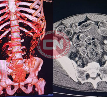 Bolivianos drogas estomago itu