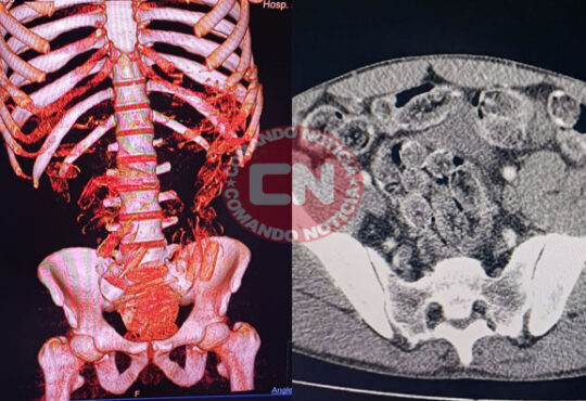 Bolivianos drogas estomago itu