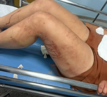 Mulher agredida em sumaré gcm