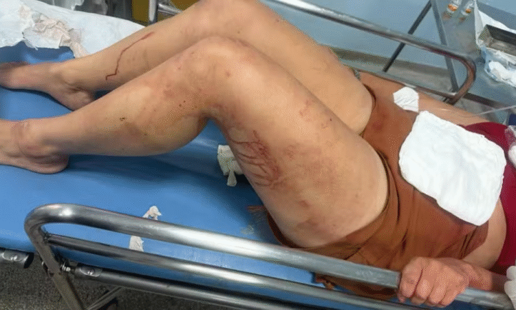 Mulher agredida em sumaré gcm