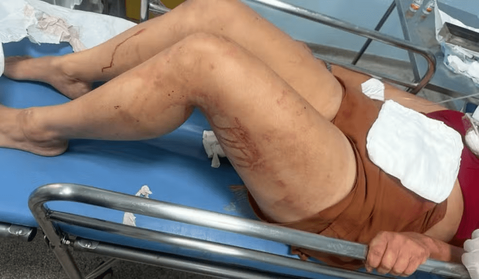 Mulher agredida em sumaré gcm