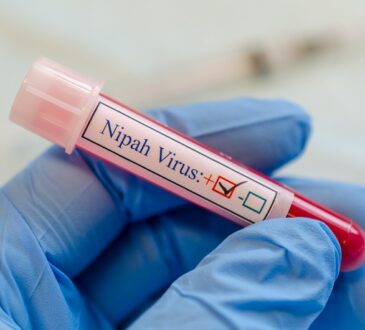 Nipah virus divulgação pequeno principe