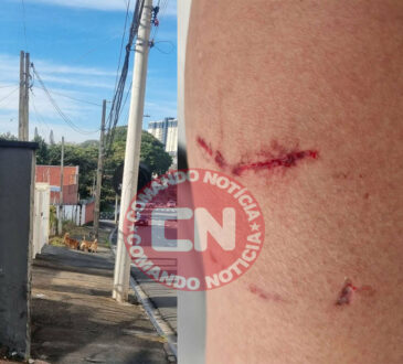 MÃe e filho mordidos caes indaiatuba