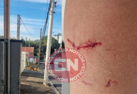 MÃe e filho mordidos caes indaiatuba