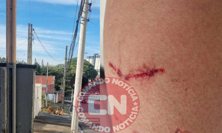 MÃe e filho mordidos caes indaiatuba