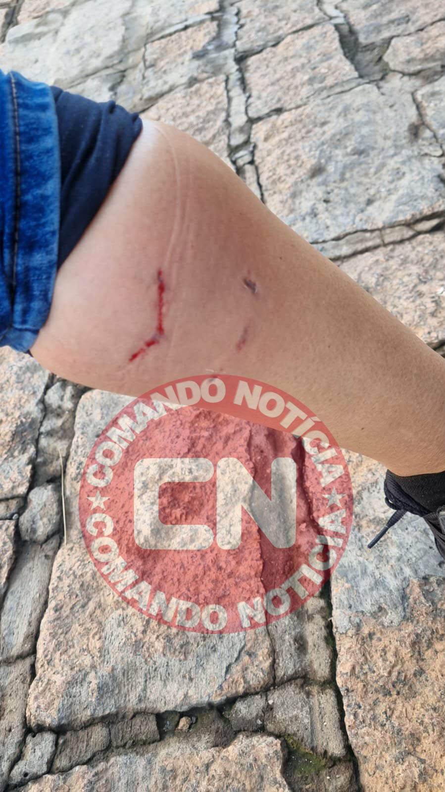 MÃe e filho mordidos caes indaiatuba 1