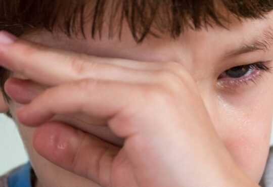 Meninoi coÇando olho. magnific eutropia