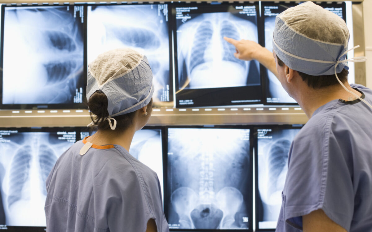 Doctors examining chest x rays