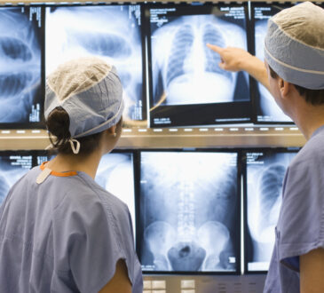 Doctors examining chest x rays