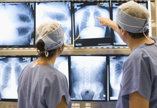 Doctors examining chest x rays