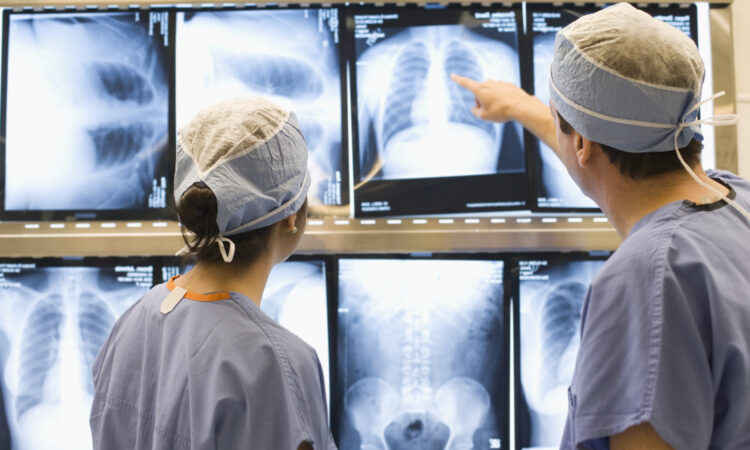 Doctors examining chest x rays